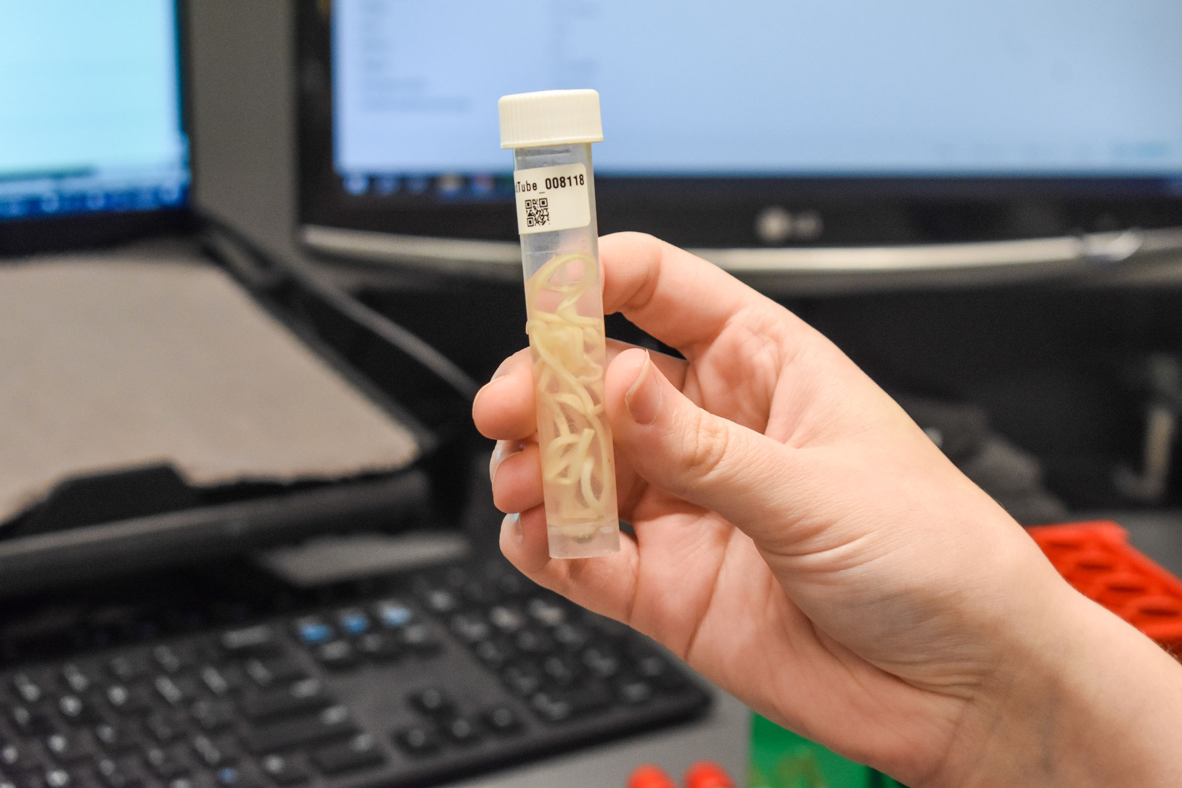 Hand holding a vial of guinea worms, which look like small, white, ribbons. 