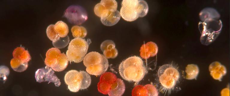 Close-up microscopic image of many small, round, multi-chambered marine microorganisms in shades of red, orange, yellow, and pale cream, floating against a dark background.